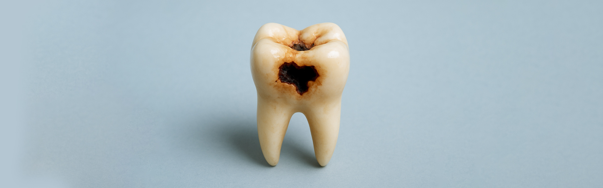 Say Goodbye to Cavities: How Dental Fillings Restore & Protect Your Smile
