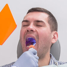 Why Tooth Extraction May Be Necessary: Understanding the Reasons