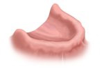 Image of Dental Procedure