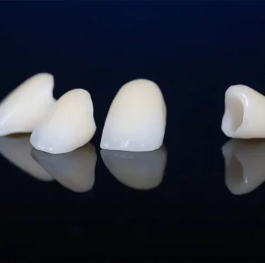 What-Happens-If-You-Delay-Getting-a-Dental-Crown